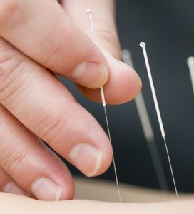 Crestwood Acupuncture